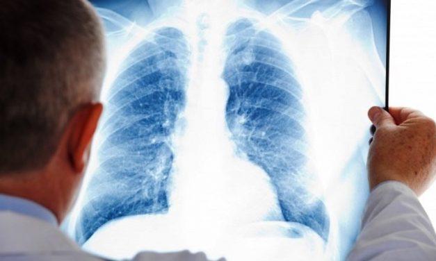 Туберкулезных больных в Павлограде теперь будут лечить по-новому