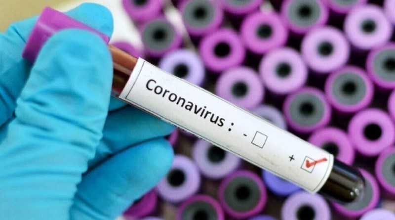 На Дніпропетровщині виявили ще один випадок коронавірусу