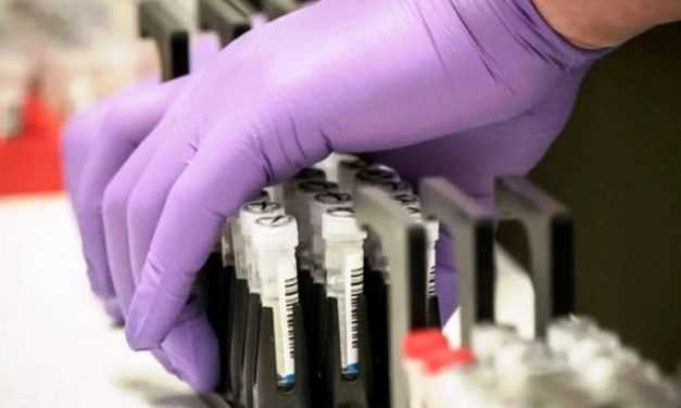 72 случая коронавирусной инфекции обнаружили в Днепропетровской области за сутки