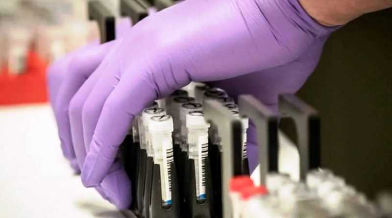 72 случая коронавирусной инфекции обнаружили в Днепропетровской области за сутки