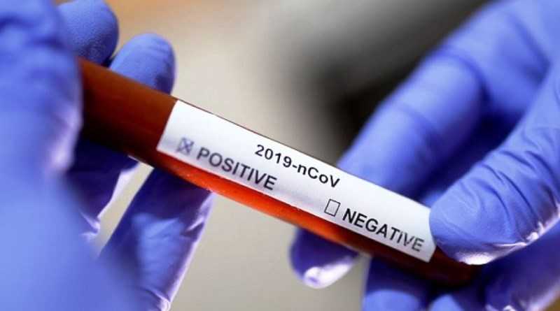 Пік захворюваності на коронавірус в Дніпропетровській області прогнозують на середину травня