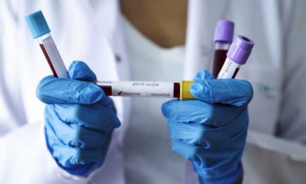 За добу в області виявили 29 хворих на коронавірус, з них 4 в Павлограді