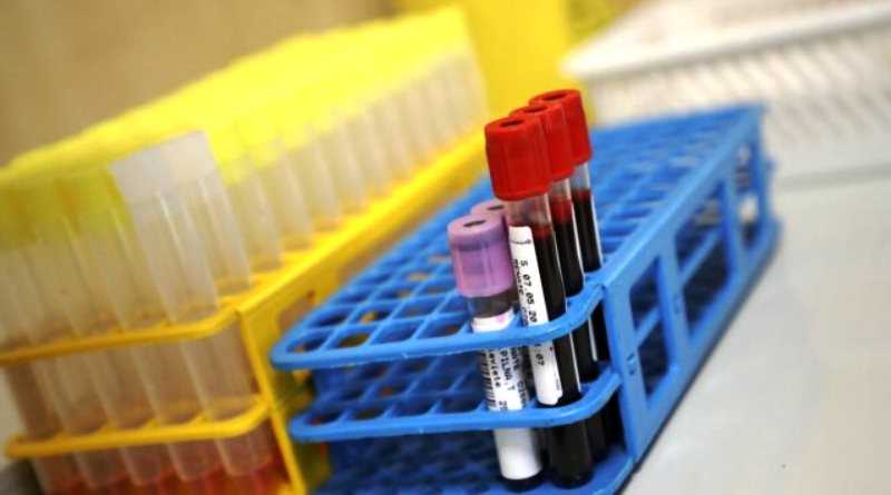 В Латвии скоро появятся недорогие тесты для массовых проверок, переболел ли уже человек Covid-19