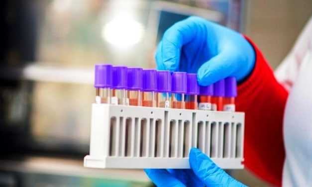 За добу на Дніпропетровщині виявили 90 випадків коронавірусу 