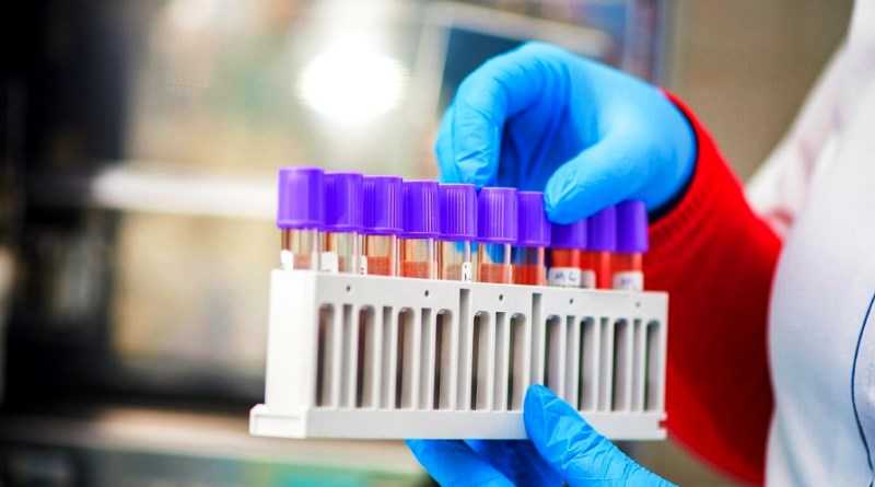 За добу на Дніпропетровщині виявили 90 випадків коронавірусу 