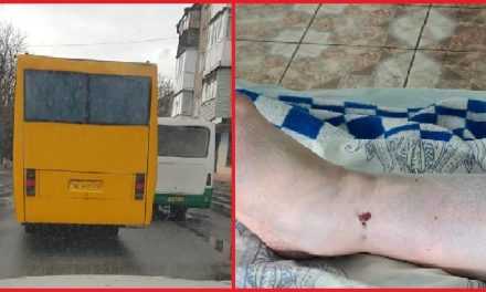 В Павлограде спасают ногу женщине, которая попала под колёса маршрутки /Видео/