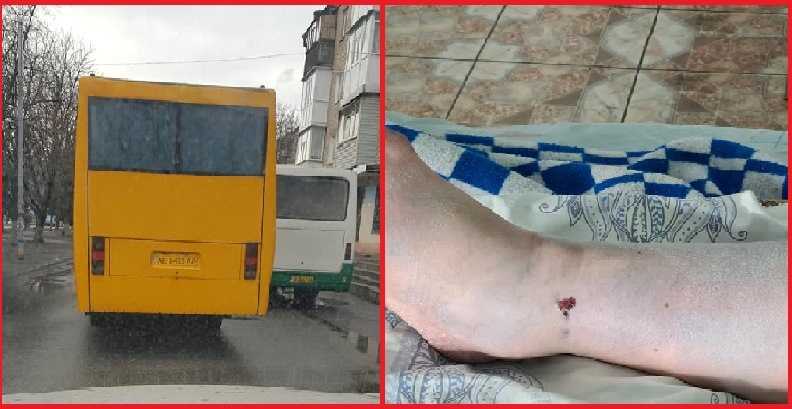 В Павлограде спасают ногу женщине, которая попала под колёса маршрутки     /Видео/